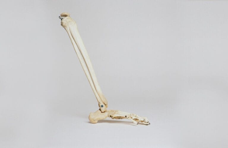 Espresso Might Considerably Shed Osteoporosis Possibility