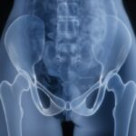 Tea May Beat Coffee for Hip Bone Health in Older Women, Study Finds